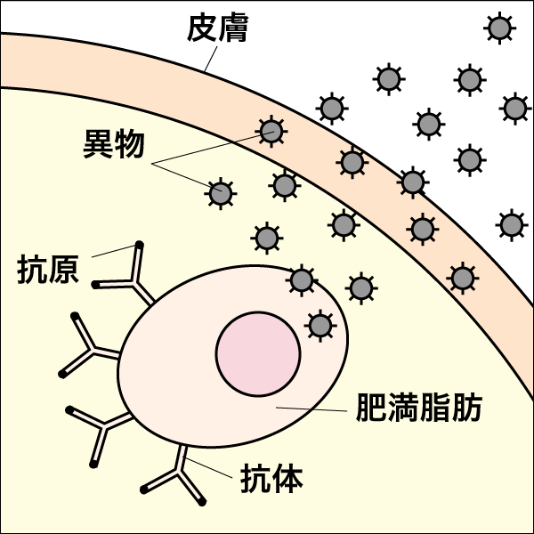 アレルギー・イラスト